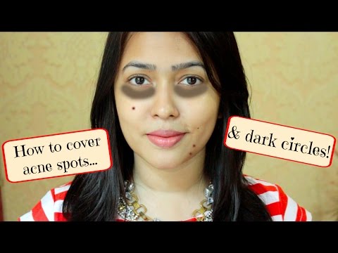 How to Cover Dark Circles & Acne/ Dark Spots/ Pimples
