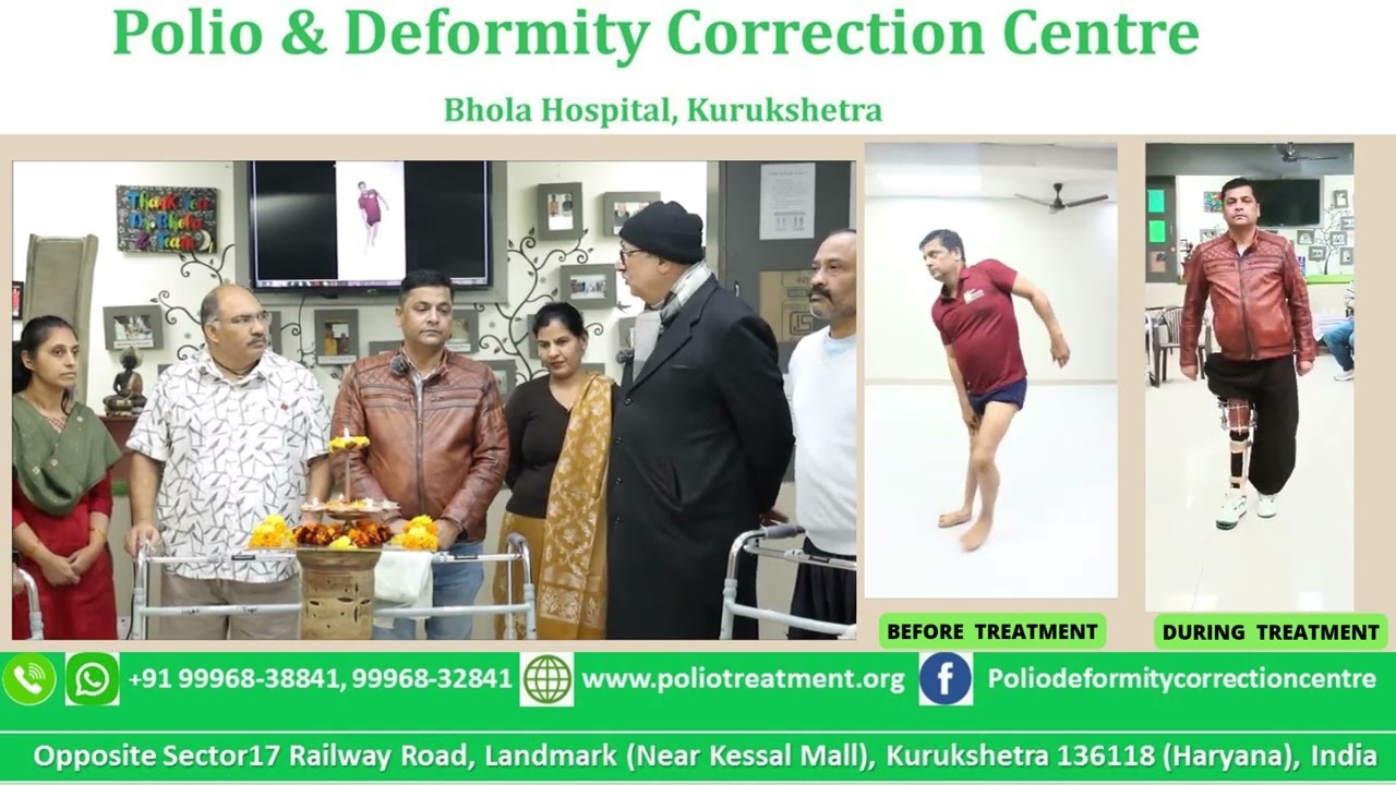 3 महीने बाद पोलियो मरीज़ की छुटी होने पर मरीजों के Review and Testimonial #polio #poliotreatment