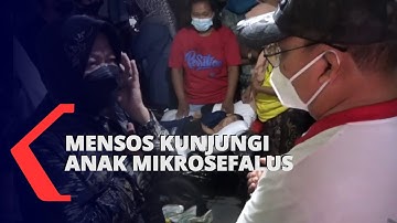 Menteri Sosial Risma Berkunjung ke Kakak Beradik Penderita Mikrosefalus di Jember