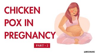Chicken pox in pregnancy | VZV part -2) | Medinare
