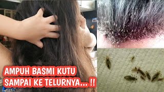 5 CARA MEMBASMI KUTU DAN TELURNYA DENGAN BAHAN AMAN DAN ALAMI