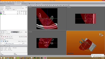 Amira Image Segmentation Tutorial