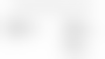 Port Placements by Indian (Manipal) Modifiction for da Vinci X Surgical System