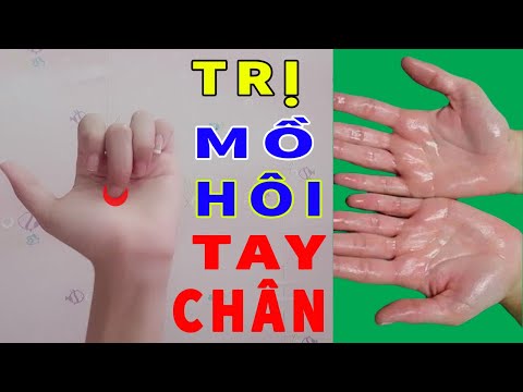 Cách Chữa Dứt Điểm Mồ hôi Tay Chân Ngay Tại Nhà Chỉ Với 3 Huyệt Vị Này