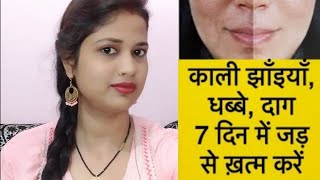 Fine Face Cream Honest Review 2022 In Hindi  Fine Face Cream Uses Side Effects  Price New