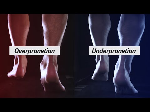 Video: Kan een overpronator neutrale schoenen dragen?