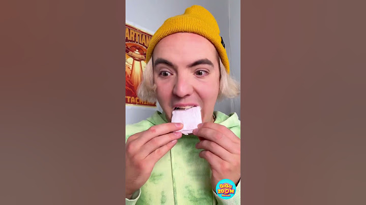 Er ersetzte MEINE Zähne durch einen FALSCHEN 🦷 #lustig