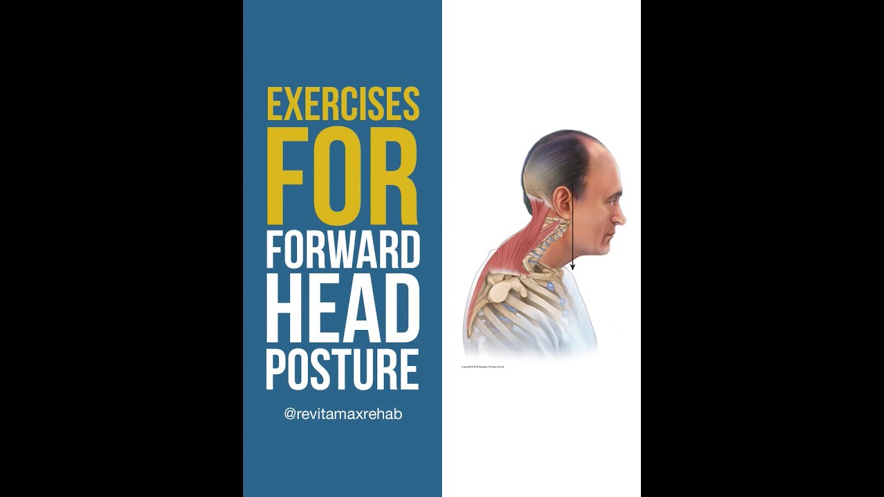 Exercises to fix forward head posture with Mo Khan Revitamax Rehab ...