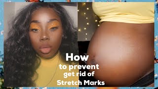 HOW TO GET RID OF / PREVENT STRETCH MARKS DURING PREGNANCY | 4 KEY PRODUCTS