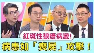 山豬38歲猝逝罹紅斑性狼瘡！病患行為如「喪屍」攻擊護理人員！【醫師好辣】必看精彩片段 賈蔚 陳榮堅 陳保仁