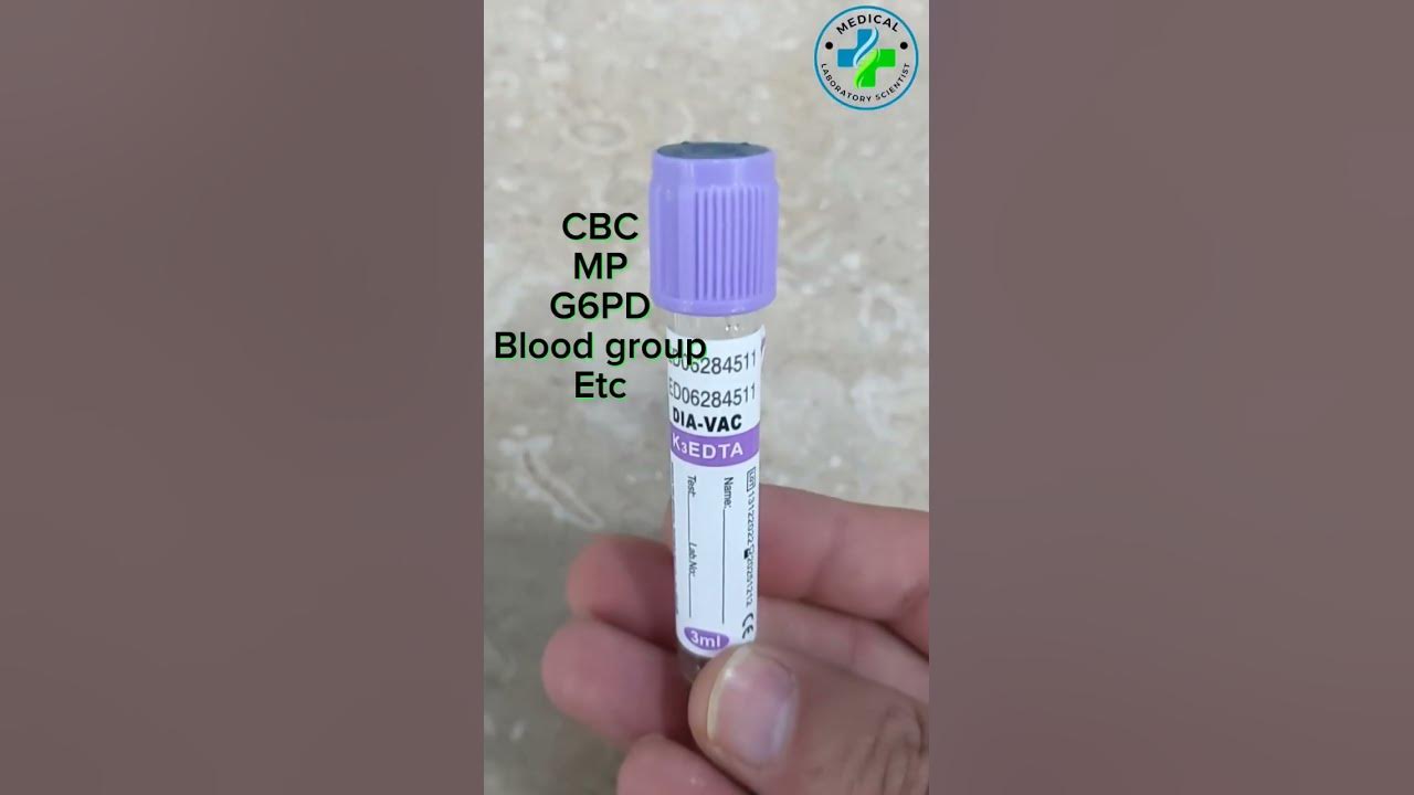 edta-anticoagulants-edta-vial-cbc-tube-blood-collection-tube