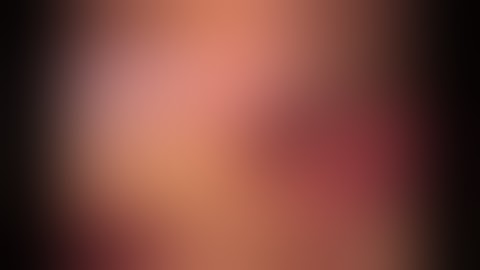 SAGES Pearls Session: Laparoscopic Sigmoid Colectomy - Tonia Young-Fadok