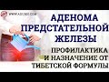 Аденома предстательной железы - Профилактика и назначение от Тибетской Формулы