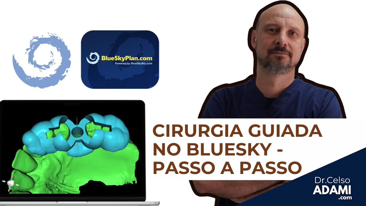 TUTORIAL COMPLETO   CRIANDO UM GUIA DE CIRURGIA GUIADA NO BLUESKY PLAN