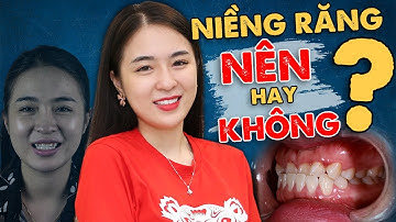 Niềng Răng Nên Hay Không - Những Sự Thật về Niềng Răng không Phải Ai Cũng Biết
