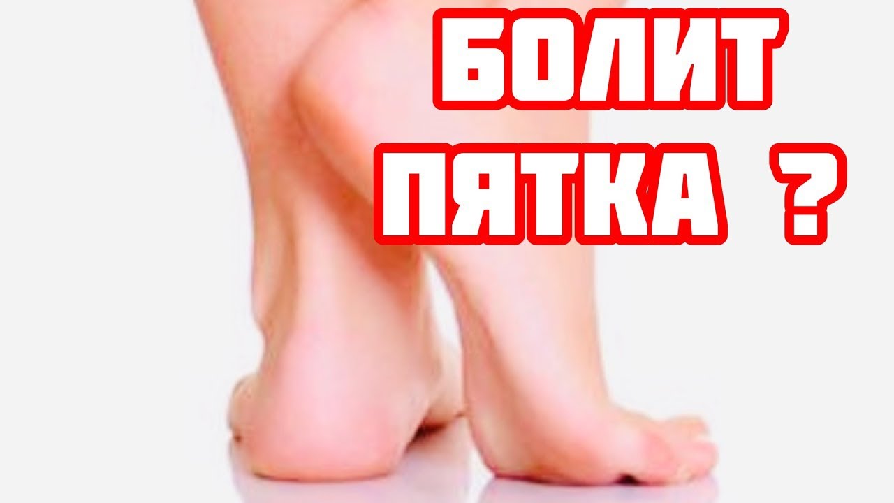 Как вылечить пяточную шпору быстро - YouTube
