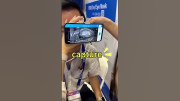 👁️ Upper Eyelid Imaging Made Easy with MeiboVue & Meivertor 🎥  #meibography  #uppereyelidmeibography