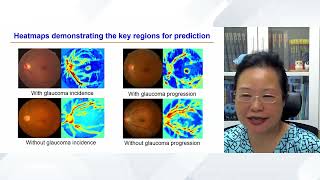 Advances of Artificial Intelligence in Glaucoma Management (prof. Zhang X., China)