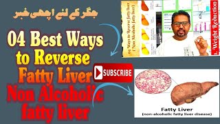 04 Best Ways to Reverse fatty liver | How to reverse fatty liver | Fatty liver