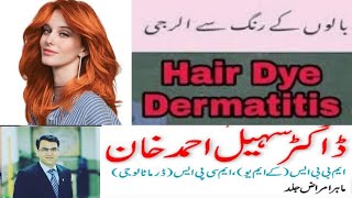 Hair Dye Dermatitis | Hair color Allergy Treatment | Hair Dye Allergy Treatment | PPD Free Hair dye