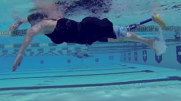 Springer Prosthetic & Orthotic Services Commercial - "Stay Healthy"