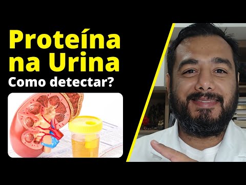 Vídeo: Proteína Na Urina - Causas E Sintomas Do Aumento De Proteína Na Urina, Tratamento E Prevenção