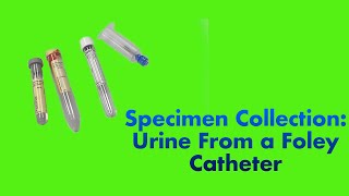 Specimen Collection: Urine from a Foley Catheter