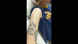 Vanish Tattoo Removal - Williamsport PA