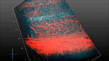 3D visualization of spinal cord motoneurons