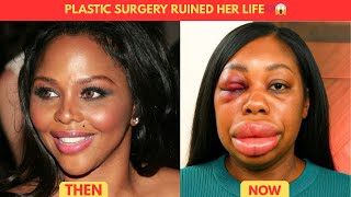 5+ ICONIC Black ACTRESSES Who Had Tragic Endings After PLASTIC Surgery