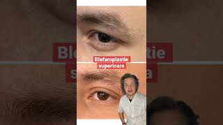 Blefaroplastie Superioara. Rezultat Dupa 10 Zile. Programari 0753876867