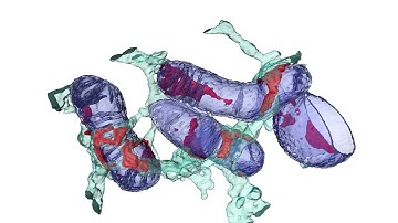 Endoplasmic Reticulum – Mitochondrial contact sites