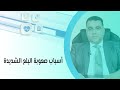 أسباب صعوبة البلع الشديدة 
