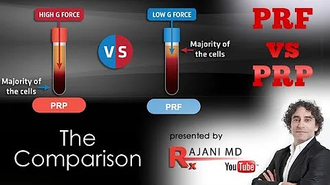 PRF vs PRP We Compare