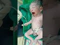 Normal delivery newborn baby boy wat 4kg