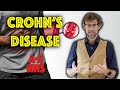 Teach me about Crohns and Inflammatory bowel disease - A to Z of the NHS - Dr Gill