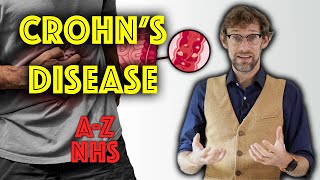 Teach me about Crohns and Inflammatory bowel disease  A to Z of the NHS  Dr Gill