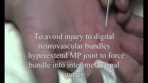 triggerrelease_0001.wmv