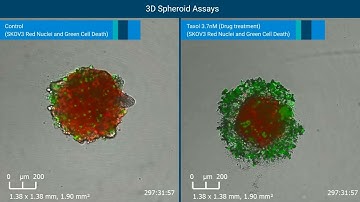 Monitoring and Quantifying 3D Tumor Spheroid Drug Cytotox by RTCA eSight Live Cell Analysis System