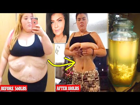 97% SUCCESS // in just 2 DAY WEIGHT LOSS REMEDY // LOSE UP TO 23 LBS IN 2 DAY || lose belly fat