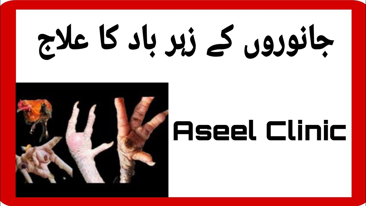 Chicken Leg Swelling And Infection Treatment/Aseel Clinic/Dr Zaman YouTube