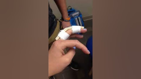 PIP Dorsal Blocking Splint
