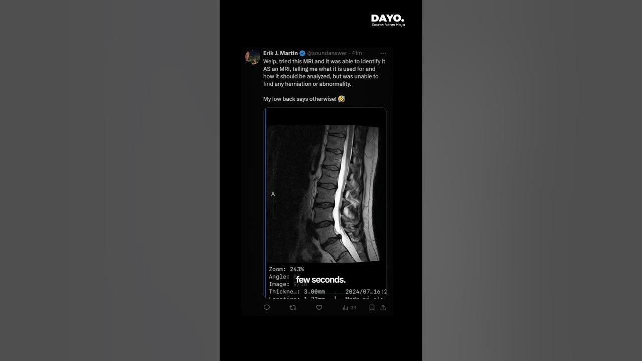 Now Grok can analyse your X-ray Reports. - YouTube