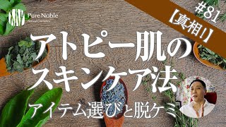 【アトピー肌のスキンケア方法！】化粧品選びや脱ケミについて〔#81〕