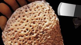 Pocketed Sponge Matrix Approaching Metal Edge Alignment in Callus Simulation
