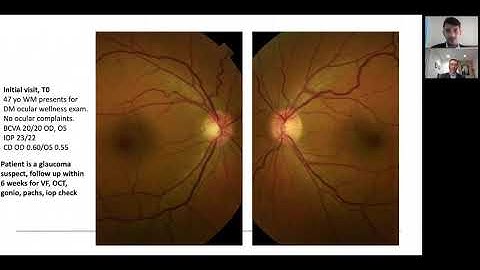 The Practical Approach to the Glaucoma Suspect