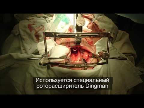 НОВОЕ В ОНКОЛОГИИ. Роботическая онкохирургия. Рак полости рта. Рак молочной железы.