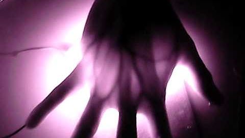 Infrared IR hand vein detection