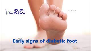 Early Signs of Diabetic Foot screenshot 4