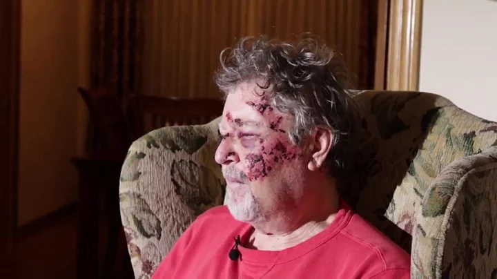 Richard Suter talks about abduction and beating